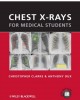 Ebook Chest Xrays for medical students